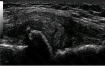 RhMSUS Question 7